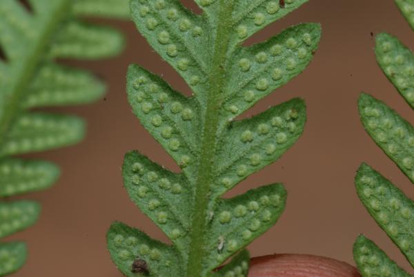 Lower surface of pinna