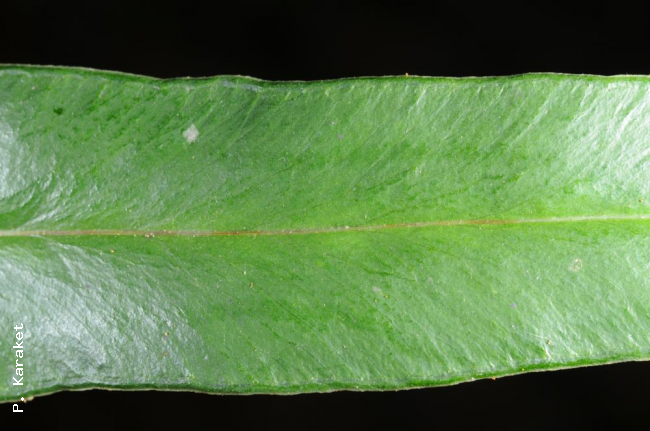 Upper surface of pinna
