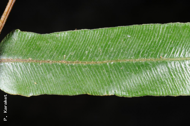 Upper surface of pinna