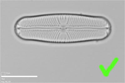 Sellaphora, parallel to frame