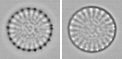 centric diatom, white_ and black-spot focuses