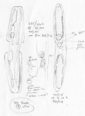 drawings of Surirella angusta